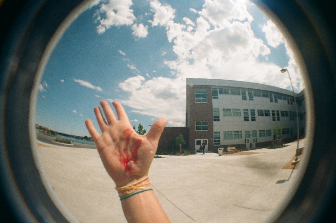 cut hand