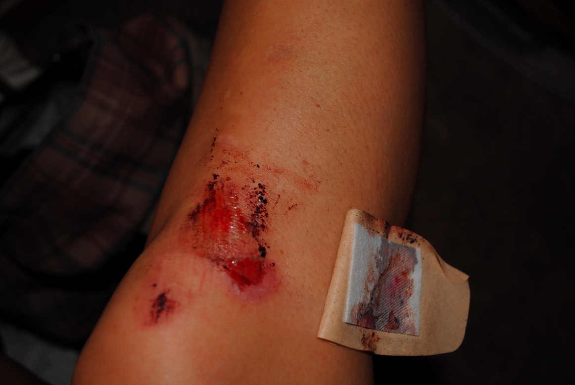 cut knee